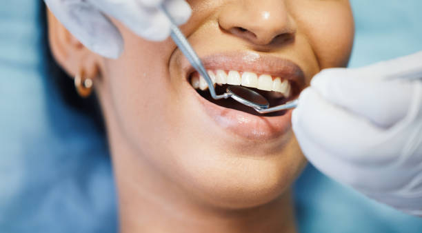 Best Emergency Dental Filling Replacement  in Williston Highlands, FL
