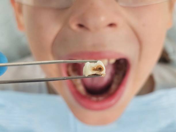 Best Chipped Tooth Repair Near Me  in Williston Highlands, FL